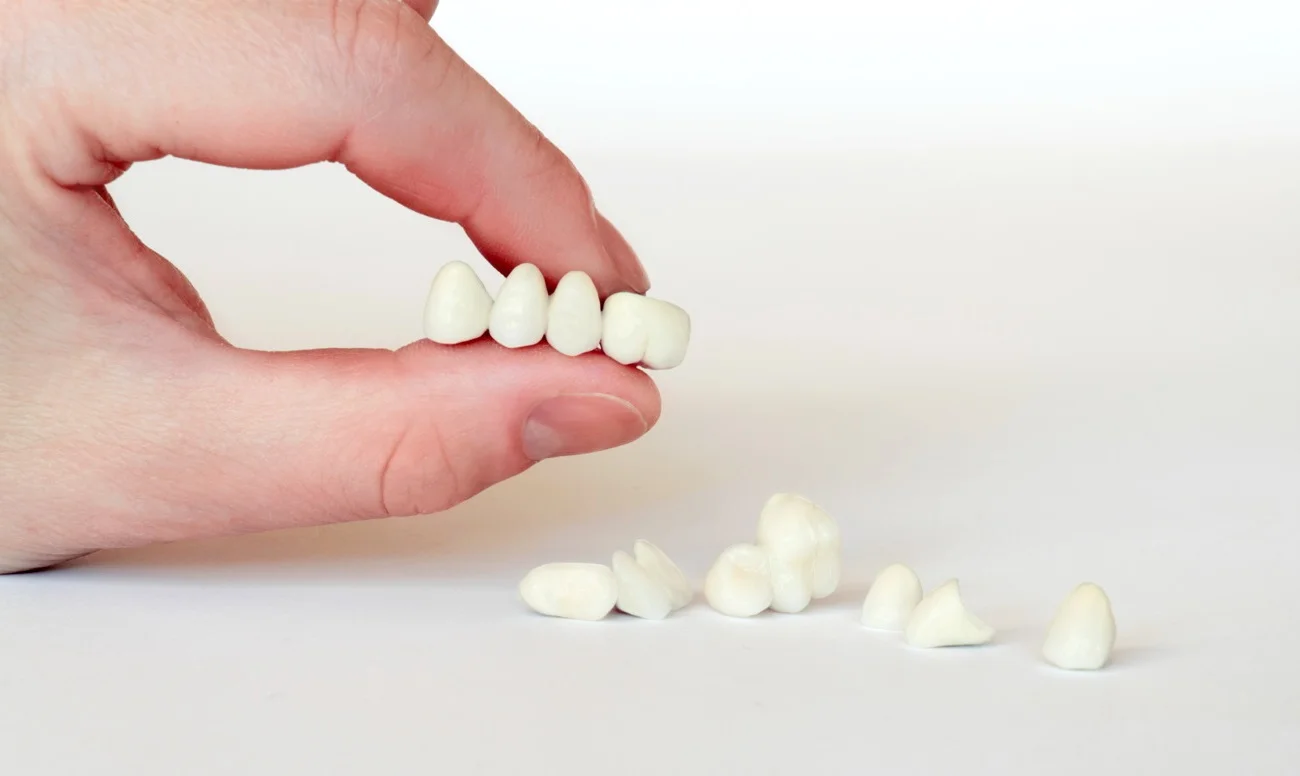 Коронки всех видов в Минске Ивалюс-Дент